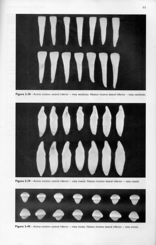 61
Figura 2-38 -Acima: incisivo central inferior - vista vestibular. Abaixo: incisivo lateral inferior - vista vestibular.
Figura 2-39 -Acima: incisivo central inferior - vista mesial. Abaixo: incisivo lateral inferior - vista mesial.
Figura 2-40 -Acima: incisivo central inferior - vista incisai. Abaixo: incisivo lateral inferior - vista incisai.
 
