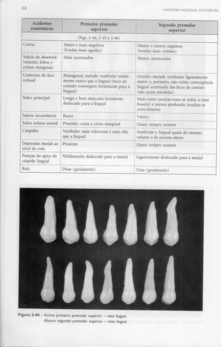 64
Acidentes
anatómicos
Primeiro premolar
superior
Segundo premolar
superior
(Figs. 2-44, 2-45 e 2-46)
Coroa
Sulcos de desenvol-
vimento, lobos e
cristas marginais
Contorno da face
oclusal
Sulco principal
Sulcos secundários
Sulco ocluso-mesial
Cúspides
Depressão mesial ao
nível do colo
Posição do ápice da
cúspide lingual
Raiz
Maior e mais angulosa
(bordas mais agudas)
Mais acentuados
Pentagonal; metade vestibular nitida-
mente maior que a lingual (faces de
contato convergem fortemente para a
lingual)
Longo e bem marcado, levemente
deslocado para a lingual
Raros
Presente; cruza a crista marginal
Vestibular mais volumosa e mais alta
que a lingual
Presente
Nitidamente deslocado para a mesial
Duas (geralmente)
Menor e menos angulosa
(bordas mais rombas)
Menos acentuados
Ovóide; metade vestibular ligeiramente
maior e, portanto, não existe convergência
lingual acentuada das faces de contato
(são quaseparalelas)
Mais curto (muitas vezes se reduz a uma
fosseta) e menos profundo; localiza-se
centralmente
Vários
Quase sempre ausente
Vestibular e lingual quase do mesmo
volume e da mesma altura
Quase sempre ausente
Ligeiramente deslocado para a mesial
Uma (geralmente)
Figura 2-44 -Acima: primeiro premolar superior - vista lingual.
Abaixo: segundo premolar superior - vista lingual.
 