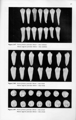 67
Figura 2-47 -Acima: primeiro premolar inferior - vista vestibular.
Abaixo: segundo premolar inferior - vista vestibular.
Figura 2-48 -Acima: primeiro premolar inferior - vista mesial.
Abaixo: segundo premolar inferior - vista mesial.
Figura 2-49 -Acima: primeiro premolar inferior - vista oclusal.
Abaixo: segundo premolar inferior - vista oclusal.
 
