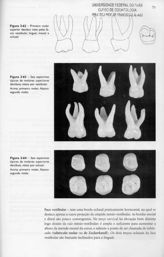 Figura 2-62 - Primeiro molar
superior decíduo visto pelas fa-
ces vestibular, lingual, mesial e
oclusal.
UNIVERSIDADE FEDERAL DO NR*
CURSO DE ODONTOLOGIA
FRANCISCO^.JbM)
n
75
Figura 2-63 - Seis espécimes
típicos de molares superiores
decíduos, vistos por vestibular.
Acima: primeiro molar. Abaixo:
segundo molar.
Figura 2-64 - Seis espécimes
típicos de molares superiores
decíduos, vistos por oclusal.
Acima: primeiro molar. Abaixo:
segundo molar.
Face vestibular - tem uma borda oclusal praticamente horizontal, na qual se
destaca apenas a suaveprojeção da cúspide mésio-vestibular. Asbordas mesial
e distai são pouco convergentes. No terço cervical há elevação bem distinta
logo abaixo da raiz mésio-vestibular; é ampla o suficiente para aumentar a
altura da metade mesial da coroa, e saliente a ponto de ser chamada de tubér-
culo (tubérculo molar ou de Zuckerkandl). Os dois terços oclusais da face
vestibular são bastante inclinados para alingual.
 
