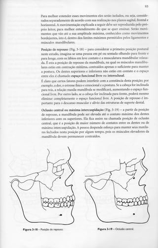 93
Para melhor entender esses movimentos eles serão isolados, ou seja, conside-
rados separadamente de acordo com sua realizaçãonos planossagital, frontal e
horizontal. A movimentação explicada a seguir deve ser reproduzida pelo pró-
prio leitor, para melhor entendimento do que se quer ensinar. Serão movi-
mentos que vão até a sua amplitude máxima, conhecidos como movimentos
bordejantes, isto é, dentro dos limites máximos permitidos pelos ligamentose
músculos mandibulares.
Posição de repouso (Fig. 3-18) - para considerar a primeira posição postural
neste estudo, imagina-se uma pessoa em pé ou sentada olhando para frente e
para longe, com os lábios em leve contato e a musculatura mandibular relaxa-
da. É esta a posição de repouso da mandíbula, na qual os músculos mandibu-
lares estão em contração mínima, contraídos apenas o suficiente para manter
a postura. Os dentes superiores e inferiores não estão em contato e o espaço
entre eles é chamado espaço funcional livre ou interoclusal.
É claro que certos fatores podem interferir com a constância desta posição; por
exemplo, a dor, o estresse físico e emocional e apostura. Sea cabeça for inclinada
para trás, a relação maxila-mandíbula se modificará,aumentando o espaço fun-
cional livre.Por outro lado, se a cabeça for inclinada para frente, poderá mesmo
eliminar completamente o espaço funcional livre. A posição de repouso é im-
portante para o descanso muscular e alívio das estruturas de suporte dental.
Oclusão central ou máxima intercuspidação (Fig. 3-19) - a partir da posição
de repouso, a mandíbula pode ser elevada até o contato máximo dos dentes
inferiores com os superiores. Ela fica assim na chamada posição de oclusão
central, que é a posição de maior número de contatos entre os dentes ou de
máxima intercuspidação. A pessoa despende esforço para manter seus maxila-
res fechados nesta posição por algum tempo, pois os músculos elevadores da
mandíbula devem permanecer contraídos.
Figura 3-18 - Posição derepouso. Figura 3-19- Oclusão centrai.
 
