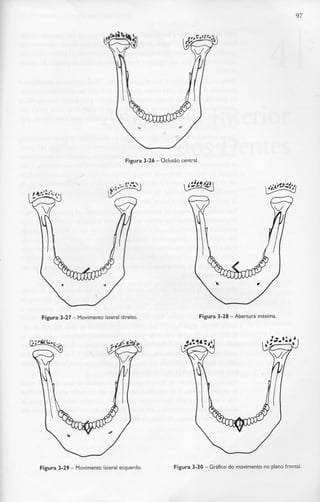 97
Figura 3-26 - Oclusão central.
Figura 3-27 - Movimento lateral direito. Figura 3-28 - Abertura máxima.
Figura 3-29- Movimento lateralesquerdo. Figura 3-30- Gráfico do movimento no plano frontal.
 