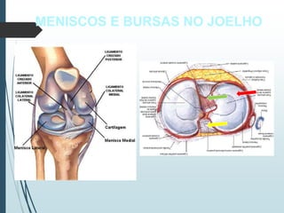 MENISCOS E BURSAS NO JOELHO
 