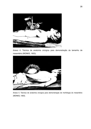 26

"
Anexo 4. Técnica de anatomia cirúrgica para demonstração de tamanho de
mesentério (MONKS, 1903).

"
Anexo 5. Técnica de anatomia cirúrgica para demonstração de morfologia do mesentério
(MONKS, 1903)."

 