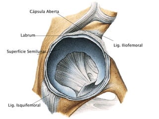 Cápsula Aberta




      Labrum

                            Lig. Iliofemoral
Superfície Semilunar




Lig. Isquifemoral
 