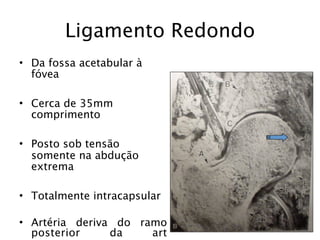 Ligamento Redondo
• Da fossa acetabular à
  fóvea

• Cerca de 35mm
  comprimento

• Posto sob tensão
  somente na abdução
  extrema

• Totalmente intracapsular

• Artéria deriva do ramo
  posterior     da    art
 