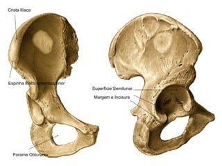 Crista Ilíaca




Espinha Ilíaca Anterosuperior
                                Superfície Semilunar

                                Margem e Incisura




  Forame Obturador
 