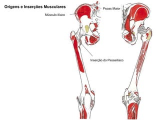 Origens e Inserções Musculares              Psoas Maior

                   Músculo Ilíaco




                           ...