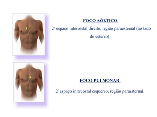 FOCO AÓRTICO
2o
espaço intercostal direito, região paraesternal (ao lado
do esterno).
FOCO PULMONAR
2º
espaço intercostal esquerdo, região paraesternal.
 