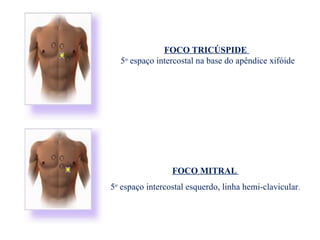 FOCO TRICÚSPIDE
5o
espaço intercostal na base do apêndice xifóide
FOCO MITRAL
5o
espaço intercostal esquerdo, linha hemi-clavicular.
 