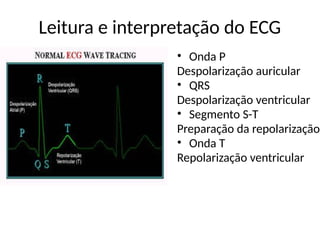 Leitura e interpretação do ECG
• Onda P
Despolarização auricular
• QRS
Despolarização ventricular
• Segmento S-T
Preparação da repolarização
• Onda T
Repolarização ventricular
 