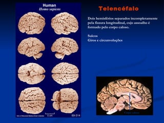 Telencéfalo
Dois hemisférios separados incompletamente
pela fissura longitudinal, cujo assoalho é
formado pelo corpo caloso.

Sulcos
Giros e circunvoluções




                         Corpo caloso
 