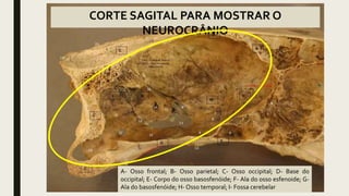 CORTE SAGITAL PARA MOSTRAR O
NEUROCRÂNIO
A- Osso frontal; B- Osso parietal; C- Osso occipital; D- Base do
occipital; E- Corpo do osso basosfenóide; F- Ala do osso esfenoide; G-
Ala do basosfenóide; H- Osso temporal; I- Fossa cerebelar
 