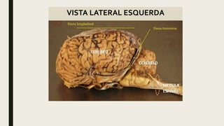 VISTA LATERAL ESQUERDA
 