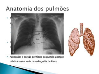 A densidade do pulmão,  não é distribuída uniformemente. 1 g/mL, próximo ao hilo  0,1 g / mL perifericamente. Mais de 50% de todos os alvéolos do pulmão estão localizados na periferia. Aplicação: a porção periférica do pulmão aparece relativamente vazia na radiografia de tórax. 