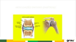 ARTICULAÇÕES SINOVIAIS (DIARTROSE)
 