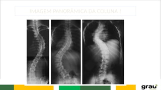 IMAGEM PANORÂMICA DA COLUNA !
 