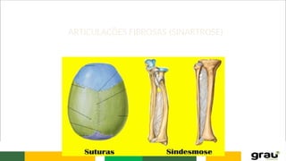 ARTICULAÇÕES FIBROSAS (SINARTROSE)
 