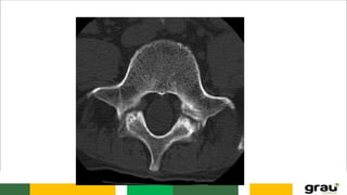 Anatomia da caixa toráxica e coluna vertebral