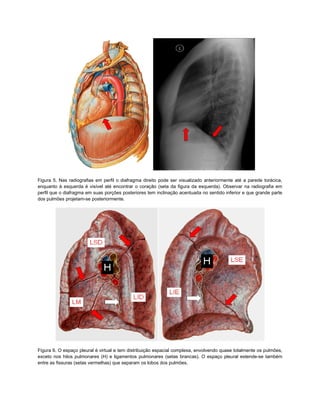 Figura 5. Nas radiografias em perfil o diafragma direito pode ser visualizado anteriormente até a parede torácica,
enquanto à esquerda é visível até encontrar o coração (seta da figura da esquerda). Observar na radiografia em
perfil que o diafragma em suas porções posteriores tem inclinação acentuada no sentido inferior e que grande parte
dos pulmões projetam-se posteriormente.




Figura 6. O espaço pleural é virtual e tem distribuição espacial complexa, envolvendo quase totalmente os pulmões,
exceto nos hilos pulmonares (H) e ligamentos pulmonares (setas brancas). O espaço pleural estende-se também
entre as fissuras (setas vermelhas) que separam os lobos dos pulmões.
 