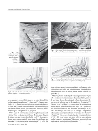 AVALIAÇÃO ANATÔMICA DO TÚNEL DO TARSO




                                                                          Fig. 6 – Vista medial do pé. Foto do septo entre o m. abdutor do hálux e
    Fig. 4 – Vista                                                        o “nó de Henry” sobre o n. plantar medial (com marcador azul)
 medial do retropé
 com septo entre o
  músculo abdutor
        do hálux e
         calcâneo
         (septo 2)                                                                                                       an
                                                                                                                       iT
                                                                                                                  sh
                                                                                                         a   yo
                                                                                                      ss
                                                                                                 Ma




                                                                          Fig. 7 – Vista medial do pé. Desenho do septo entre o m. abdutor do
                                                                          hálux e o “nó de Henry” sobre o n. plantar medial (septo 1)
                                                                      i
                                                               Ta osh
                                                                   ay




                                                                          observado um septo rígido entre a fáscia profunda do mús-
                                                                  n
                                                                ss
                                                             Ma




                                                                          culo abdutor do hálux e o assoalho ósseo formando dois
Fig. 5 – Desenho da vista medial do retropé com septo entre o músculo     túneis estreitos sobre os nervos plantar medial e lateral (fi-
abdutor do hálux e o calcâneo (septo 2)                                   guras 4 e 5).
                                                                            O nervo plantar medial pode ser comprimido no trajeto
                                                                          sob a borda superior do músculo abdutor do hálux, através
tarso, quando o nervo tibial se curva ao redor do maléolo                 de um hiato fibroso formado pela cabeça do músculo fle-
medial, na análise de Paturet(5) e Lam et al.(2). Na peça ana-            xor curto do hálux, o que foi destacado por Testut et al.(21),
tômica nº 28, foi encontrado indício de compressão do ner-                Gardner et al.(6) e Mann(7). A compressão do nervo plantar
vo tibial sob o retináculo dos flexores; o nervo tibial apre-             medial sob o músculo abdutor do hálux, no cruzamento
sentava um tumor cístico, que teve como resultado anato-                  das bainhas dos tendões dos músculos flexor longo do há-
mopatológico o diagnóstico de ganglion.                                   lux e flexor longo dos dedos (nó de Henry), e o ligamento
   Outro local de compressão dos nervos plantares medial                  calcâneo navicular plantar foram observados por Baxter(22)
e lateral foi a borda superior fibrosa do músculo abdutor                 e Kaplan(23). Em nossas dissecações das peças anatômicas
do hálux, com que concordam Bailie et al.(20). A compres-                 nºs 16 e 18, observamos um septo sobre o nervo plantar
são do nervo plantar medial, nesse local, foi detalhada por               medial e na peça anatômica nº 14 sobre o nervo tibial, que
Nagaoka(13). Em nossas peças anatômicas nºs 18 e 26, foi                  ainda não se havia dividido (figuras 6 e 7).
Rev Bras Ortop _ Vol. 35, Nº 8 – Agosto, 2000                                                                                                287
 