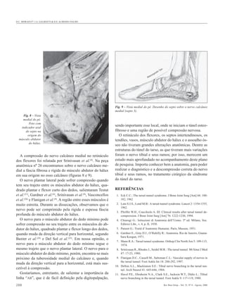 D.C. MORAES Fº, J.A. GALBIATTI & H.S. ALMEIDA FIALHO




                                                                                                                            n
                                                                                                                         Ta
                                                                                                                    hi
                                                                                                           y   os
                                                                                                    s   sa
                                                                                               Ma




                                                                    Fig. 9 – Vista medial do pé. Desenho do septo sobre o nervo calcâneo
                                                                    medial (septo 3).
    Fig. 8 – Vista
    medial do pé.
        Foto com
   indicador azul
                                                                    sendo importante esse local, onde se iniciam o túnel osteo-
      do septo na                                                   fibroso e uma região de possível compressão nervosa.
       origem do                                                       O retináculo dos flexores, os septos intertendinosos, os
  músculo abdutor                                                   tendões, vasos, músculo abdutor do hálux e o assoalho ós-
        do hálux.
                                                                    seo não tiveram grandes alterações anatômicas. Dentre as
                                                                    estruturas do túnel do tarso, as que tiveram mais variações
   A compressão do nervo calcâneo medial no retináculo              foram o nervo tibial e seus ramos; por isso, merecem um
dos flexores foi relatada por Srinivasan et al.(8). Na peça         estudo mais aprofundado no acompanhamento deste plano
anatômica nº 26 encontramos sobre o nervo calcâneo me-              de pesquisa. Importa conhecer bem a anatomia, para poder
dial a fáscia fibrosa e rígida do músculo abdutor do hálux          realizar o diagnóstico e a descompressão correta do nervo
em sua origem no osso calcâneo (figuras 8 e 9).                     tibial e seus ramos, no tratamento cirúrgico da síndrome
   O nervo plantar lateral pode sofrer compressão quando            do túnel do tarso.
tem seu trajeto entre os músculos abdutor do hálux, qua-
drado plantar e flexor curto dos dedos, salientaram Testut          REFERÊNCIAS
et al.(21), Gardner et al.(6), Srinivasan et al.(8), Vasconcellos    1. Eck C.C.: The tarsal tunnel syndrome. J Bone Joint Surg [Am] 44: 180-
et al.(26) e Flanigan et al.(9). A região entre esses músculos é        182, 1962.
muito estreita. Durante as dissecações, observamos que o             2. Lam S.J.S., Lond M.B.: A tarsal-tunnel syndrome. Lancet 2: 1354-1355,
                                                                        1962.
nervo pode ser comprimido pela rígida e espessa fáscia
                                                                     3. Pfeiffer W.H., Cracchiolo A. III: Clinical results after tarsal tunnel de-
profunda do músculo abdutor do hálux.                                   compression. J Bone Joint Surg [Am] 76: 1222-1230, 1994.
   O nervo para o músculo abdutor do dedo mínimo pode                4. Chiarugi G.: Istituzioni di Anatomia dell’Uomo. 3ª ed. Milano, Soc.
sofrer compressão no seu trajeto entre os músculos do ab-               Editrici Libr., v. 4, p. II, 1930.
dutor do hálux, quadrado plantar e flexor longo dos dedos,           5. Paturet G.: Traité d’Anatomie Humaine. Paris, Masson, 1951.
quando muda da direção vertical para horizontal, segundo             6. Gardner E., Gray D.J., O’Rahilly R.: Anatomia. Rio de Janeiro, Guana-
                                                                        bara Koogan, 1971.
Baxter et al.(24) e Del Sol et al.(25). Em nossa opinião, o
                                                                     7. Mann R.A.: Tarsal tunnel syndrome. Orthop Clin North Am 5: 109-115,
nervo para o músculo abdutor do dedo mínimo segue o                     1974.
mesmo trajeto que o nervo plantar lateral. O nervo para o            8. Srinivasan R., Rhodes J., Seidel M.R.: The tarsal tunnel. Mt Sinai J Med
músculo abdutor do dedo mínimo, porém, encontra-se mais                 47: 17-23, 1980.
próximo da tuberosidade medial do calcâneo e, quando                 9. Flanigan D.C., Cassell M., Saltzman C.L.: Vascular supply of nerves in
                                                                        the tarsal tunnel. Foot Ankle Int 18: 288-292, 1997.
muda da direção vertical para a horizontal, está mais sus-
                                                                    10. Dellon A.L., Mackinnon S.E.: Tibial nerve branching in the tarsal tun-
cetível à compressão.                                                   nel. Arch Neurol 41: 645-646, 1984.
   Gostaríamos, entretanto, de salientar a importância da           11. Havel P.E., Ebraheim N.A., Clark S.E., Jackson W.T., Didio L.: Tibial
linha “AB”, que é de fácil definição pela digitopalpação,               nerve branching in the tarsal tunnel. Foot Ankle 9: 117-119, 1988.

288                                                                                                                             Rev Bras Ortop _ Vol. 35, Nº 8 – Agosto, 2000
 