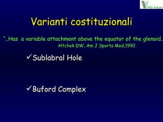Varianti costituzionali Sublabral Hole Buford Complex “ ..Has  a variable attachment above the equator of the glenoid..” Altchek DW, Am J Sports Med,1992 