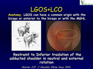 LGOS+LCO Restraint to Inferior traslation of the adducted shoulder in neutral and external rotation Warner JJP. J Shoulder Elbow Surg 1993. Anatomy.  LGOS can have a common origin with the biceps or anterior to the biceps or with the MGHL 