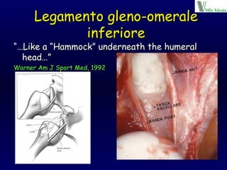 Legamento gleno-omerale inferiore “… Like a “Hammock” underneath the humeral head…” Warner Am J Sport Med, 1992 
