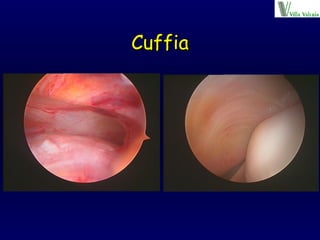 Cuffia 