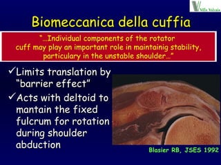 Biomeccanica della cuffia Limits translation by “barrier effect” Acts with deltoid to mantain the fixed fulcrum for rotation  during shoulder abduction “… Individual components of the rotator  cuff may play an important role in maintainig stability, particulary in the unstable shoulder…” Blasier RB, JSES 1992 