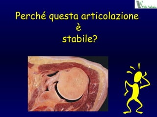 Perché questa articolazione  è  stabile? 