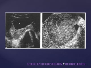 anatomia-ecografica-de-utero-pptx