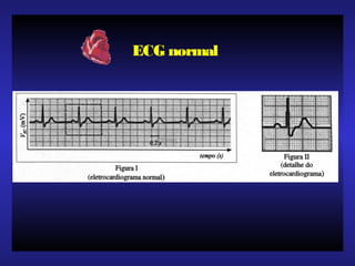 ECG normal
 