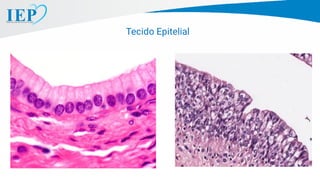 Tecido Epitelial
 