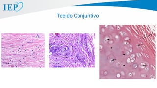 Tecido Conjuntivo
 