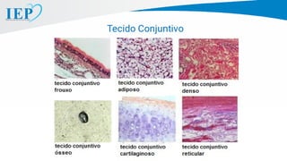 Tecido Conjuntivo
 