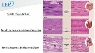 Tecido muscular liso
Tecido muscular Estriado cardíaco
Tecido muscular estriado esquelético
 