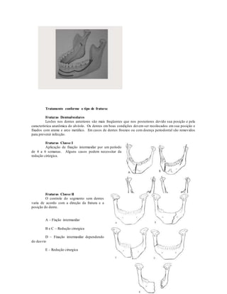Tratamento conforme o tipo de fratura:
Fraturas Dentoalveolares
Lesões nos dentes anteriores são mais freqüentes que nos posteriores devido sua posição e pela
característica anatômica do alvéolo. Os dentes em boas condições devem ser recolocados em sua posição e
fixados com arame e arco metálico. Em casos de dentes frouxos ou com doença periodontal são removidos
para prevenir infecção.
Fraturas Classe I
Aplicação de fixação intermaxilar por um período
de 4 a 6 semanas. Alguns casos podem necessitar da
redução cirúrgica.
Fraturas Classe II
O controle do segmento sem dentes
varia de acordo com a direção da fratura e a
posição do dente.
A – Fixção intermaxilar
B e C – Redução cirurgica
D – Fixação intermaxilar dependendo
do desvio
E – Redução cirurgica
 