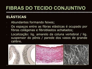 - Abundantes formando feixes;
- Os espaços entre as fibras elásticas é ocupado por
fibras colágenas e fibroblastos achatados;
- Localização: lig. amarelo da coluna vertebral / lig.
suspensor do pênis / parede dos vasos de grande
calibre.
FIBRAS DO TECIDO CONJUNTIVO
ELÁSTICAS
 