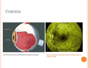 CORÓIDE
Site:http://www.coll.med.br/uploads/images/coroide.jpg Site:http://farm5.staticflickr.com/4077/4769074046_c0
1c8984ea_z.jpg
 