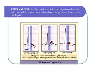Sistema de Conducción Cardiaca