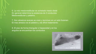 8. El piso de forma triangular o trapezoidal y en los
angulos se encuentran los conductos
6. La raíz mesiovestibular es achatado mesio distal
En general determina la existencia de 2 conductos
Mesiovestibular y palatino.
7. Son atresicos aveces se unen y terminan en un solo foramen
El mas atresico es el palatino y de difícil tratamiento.
 