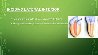 • Se asemeja en todo al incisivo central inferior.
• En algunos casos pueden presentar dos conductos.
INCISIVO LATERAL INFERIOR
 