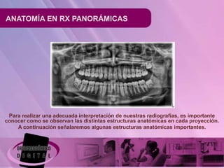 ANATOMÍA EN RX PANORÁMICAS




 Para realizar una adecuada interpretación de nuestras radiografías, es importante
conocer como se observan las distintas estructuras anatómicas en cada proyección.
    A continuación señalaremos algunas estructuras anatómicas importantes.
 