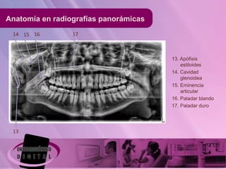 Anatomía en radiografías panorámicas
 14 15 16        17



                                       13. Apófisis
                                           estiloides
                                       14. Cavidad
                                           glenoidea
                                       15. Eminencia
                                           articular
                                       16. Paladar blando
                                       17. Paladar duro




 13
 