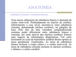 ANATOMIA Substância Cinzenta e Substância Branca Essa massa subjacente de substância branca é chamada de centro semi-oval. Profundamente no interior do cérebro, inferiormente a esse nível, encontra-se mais substância cinzenta, denominada núcleos cerebrais, ou gânglios da base. Pelo fato de uma varredura computadorizada craniana poder diferenciar entre substância branca e cinzenta, um corte através dos núcleos cerebrais fornece uma riqueza de informações diagnósticas. Um corte horizontal ou axial do hemisfério cerebral direito aponta as áreas geralmente visualizadas. As áreas de substância branca incluem o corpo caloso e o centro semi-oval. As áreas de substância cinzenta incluem os núcleos cerebrais, o tálamo e o córtex cerebral . 