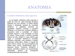 ANATOMIA Cavidades Orbitárias (vista superior) As cavidades orbitárias estão expostas a partir de cima na  pela remoção da placa orbitária do osso frontal. A órbita direita ilustra a plenitude normal da cavidade orbitária. A glândula lacrimal no quadrante superior externo, a gordura orbitária e os músculos oculares ajudam a preencher toda a cavidade. A artéria carátida interna é vista entrando na base do crânio. Nesse ponto, a artéria carótida interna já deu origem a uma artéria que supre o conteúdo orbitário.A cavidade orbitária esquerda, com gordura e alguns músculos removidos, ilustra o trajeto do nervo ártico, maior, em sua emergência do bulbo para cursar medialmente para o quiasma ártico. Tumores orbitários e corpos estranhos podem ser prontamente detectados através de tomografia computadorizada das órbitas . 