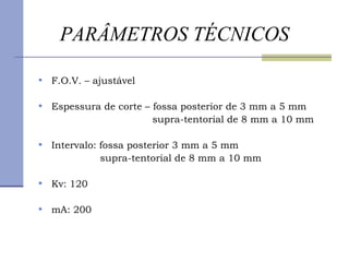 PARÂMETROS TÉCNICOS F.O.V. – ajustável Espessura de corte – fossa posterior de 3 mm a 5 mm supra-tentorial de 8 mm a 10 mm Intervalo: fossa posterior 3 mm a 5 mm supra-tentorial de 8 mm a 10 mm Kv: 120 mA: 200 