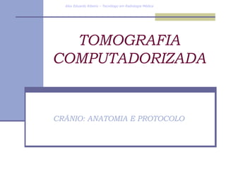 TOMOGRAFIA COMPUTADORIZADA CRÂNIO: ANATOMIA E PROTOCOLO Alex Eduardo Ribeiro – Tecnólogo em Radiologia Médica 